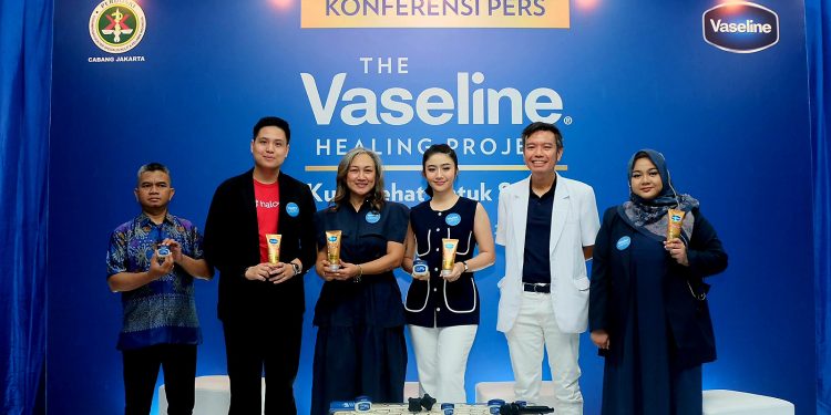 Vaseline Healing Project 2024 Berikan Layanan Pengobatan Kulit Gratis